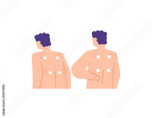 illustration of a man wearing a transdermal patch to relieve shoulder aches and pains. warm up. external medicine. treatment. flat style. vector design
