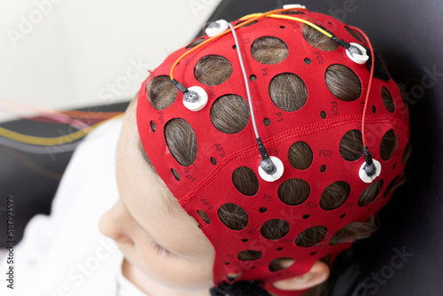 Girl wearing headgear during a session of biofeedback therapy photo