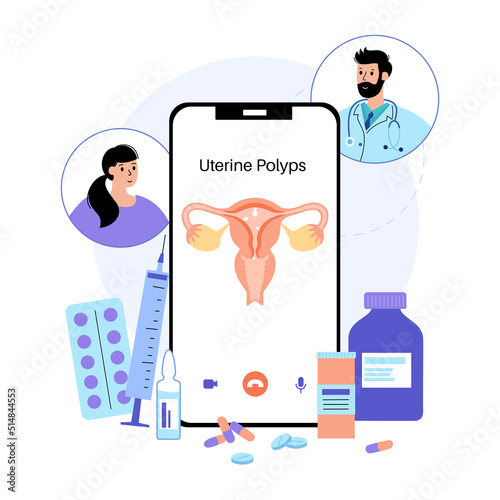 Uterus Polyps