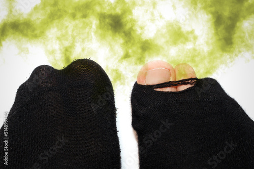Male feet in old smelly and dirty socks photo