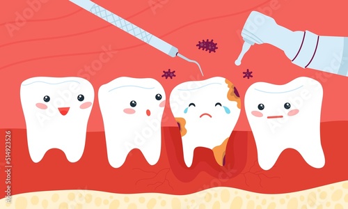 Dentist teeth treatment. Clean tooth on dental clinic, comic fun molar correction with stomatology tools. Wobbly in mouth, toothache and oral hygiene decent vector scene