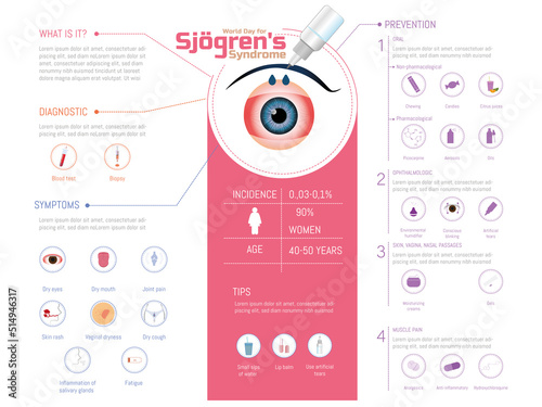 World Sjögren's Syndrome Day, Infographic of eyes with artificial tears falling on them to moisturize on a white background. Icons of symptoms and prevention to take into account . photo