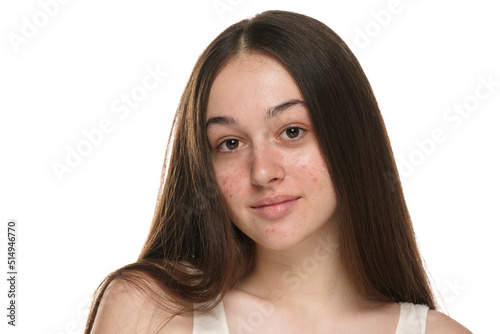 beautiful young smiling women with problemati skin