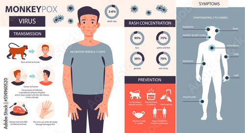 Monkeypox virus infographic. Infection, symptoms, prevention of the disease of monkey pox. Flat vector illustration photo
