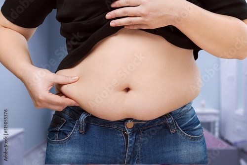Cropped of overweight fat woman holding tummy flabs with obesity. Inclination body. Adipose stomach. Big size.