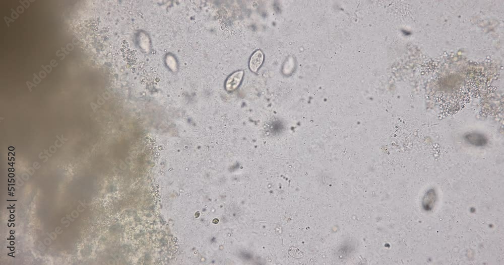 Bacteria and Protozoa in waste water under the microscope. Bacteria and Protozoa in waste water under the microscope.