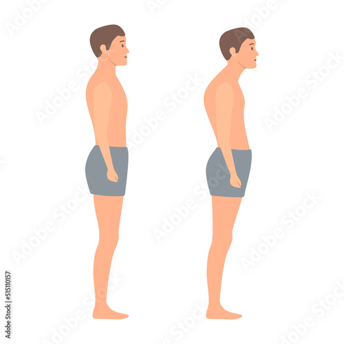 Good and bad posture on male body in side view. Spine curvature with proper and poor stance. Right and wrong pose comparison. Medical vector illustration.