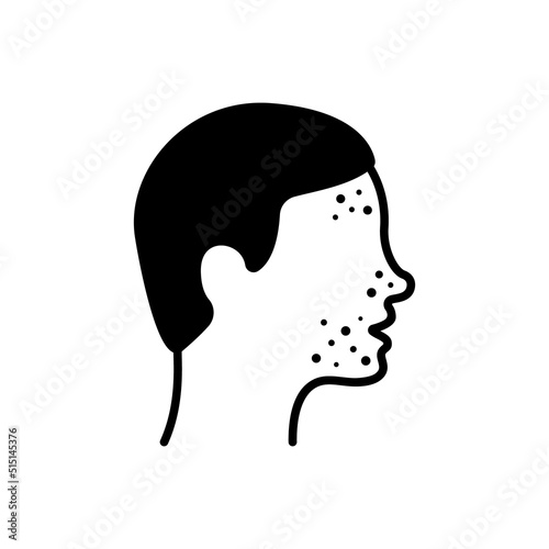 Boy with Pimples on Face Silhouette Icon. Man with Blackhead, Acne, Rash Pictogram. Dermatologic Problem, Allergy, Inflammation Skin Black Icon. Isolated Vector Illustration