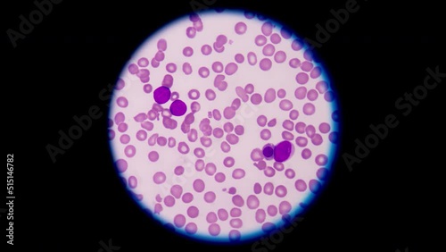 Mixed cells in stop motion footage.