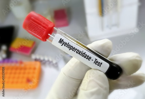 Blood sample for Myeloperoxidase (MPO) test with blurred laboratory background. photo