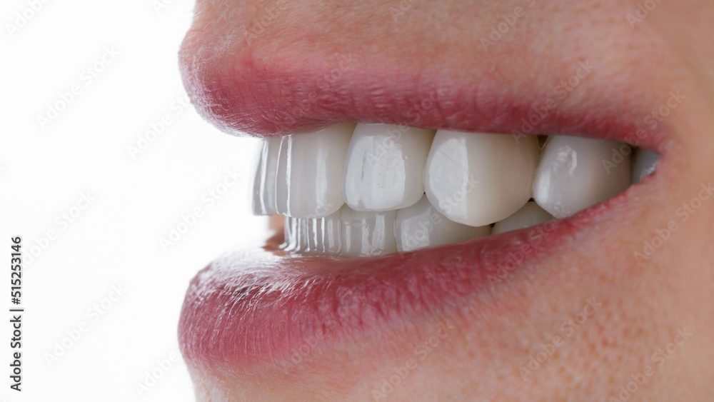 Obraz premium smile with ceramic veneers, side view on a white background