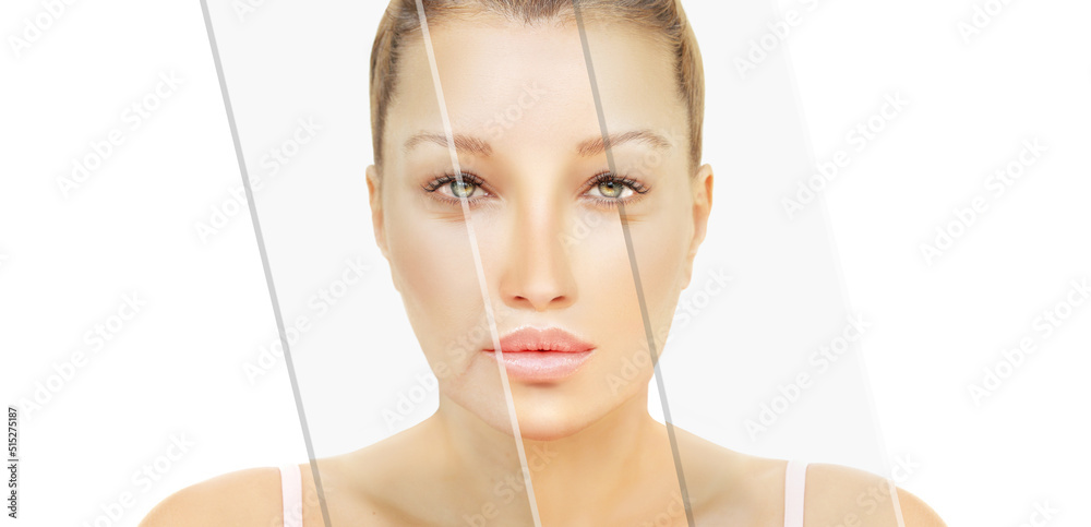 © lado2016 - Effects of ageing,Frownscowl lines ,Nasolabial folds,Neck ,Under eye circles,neck lines. Plastic Surgery Results