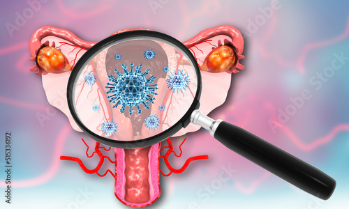 Virus, bacteria infected uterus with magnifying glass. 3d illustration. photo