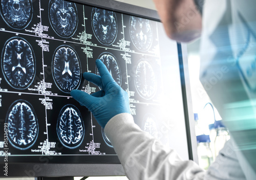 Doctor analyzing patients brain scan on screen photo