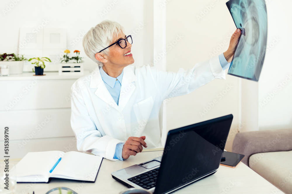 Obraz premium Female doctor looking chest x-ray film in hospital. Doctor examining a lung radiography. Doctor checking chest x-ray film at hospital.