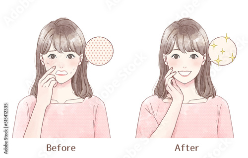 Obraz na plátně Illustration set of a woman suffering from pore trouble.