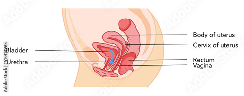 Prolapse cystocele Female reproductive system uterus with inscriptions text. Side view Human anatomy internal organs location scheme flat style icon. Vector medical illustration color concept isolated