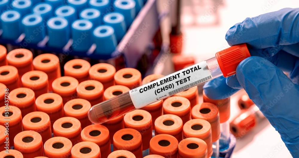 Foto de Complement Total (CH50) Test tube with blood sample in ...