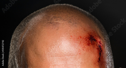 abrasion on the head close-up isolated