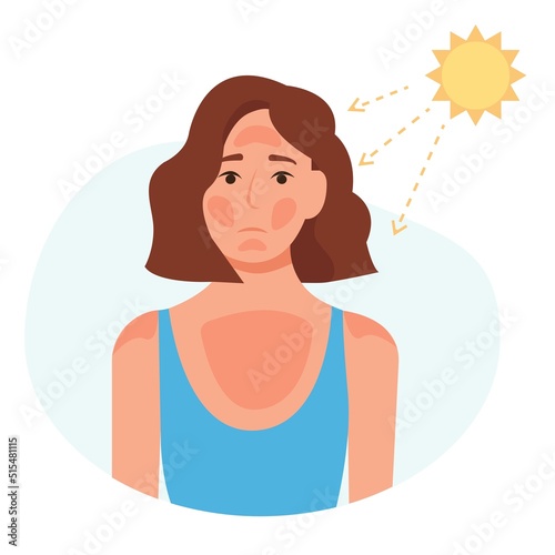 Sad woman with sunburn on his face. UV radiation damage skin in hot summer day. Health of the skin. Vector illustration photo