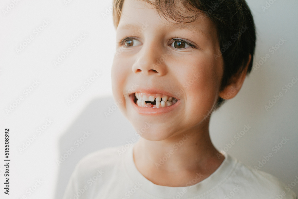 The boy holds a missing milk tooth in the palm of his hand The boy holds a missing milk tooth in the palm of his hand