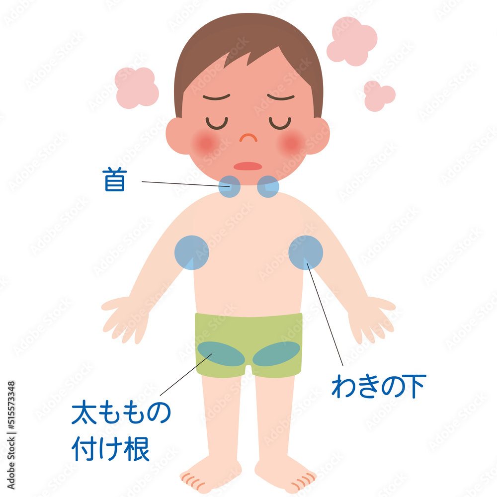 熱中症の時の冷却部位(子ども) 熱中症の時の冷却部位(子ども)