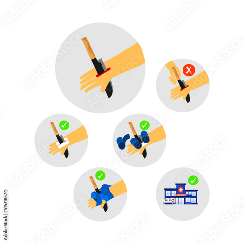 Illustration of puncture wound. The first aid of  Puncture wound and object.