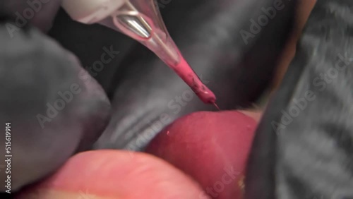 Close-up of a permanent makeup procedure. A needle pierces the lips and injects paint under the skin. Macro