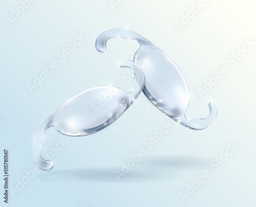 Cataract surgery, intraocular lens that will restore your vision. Corrective eyewear. Intraocular Lens Dislocation (IOL)