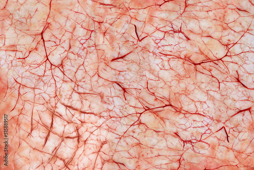 Red inflammatory capillaries on the skin. Abstract network of vessels of animal origin. The concept of blood flow. Medical examination. Macro photography.