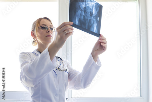 Osteotomy of the femur. A doctor examines an X-ray before a femoral osteotomy operation. photo