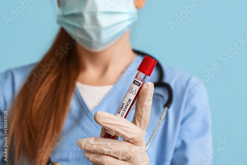 Doctor with sample of monke...