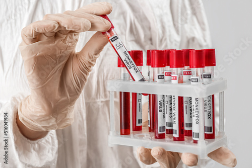 Scientist with samples of m...