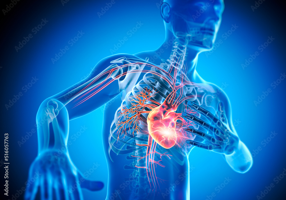 Ταπετσαρία X-ray 3D illustration of man with chest pain - heart attack