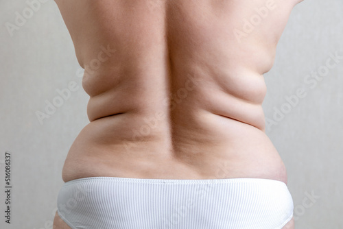 Fototapeta Back of a fat woman with thick folds on a neutral beige background