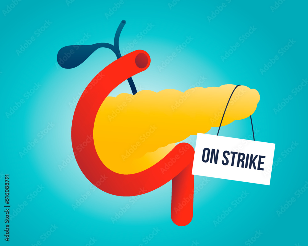 Pancreas on strike. Types of diabetes mellitus. Either the pancreas not