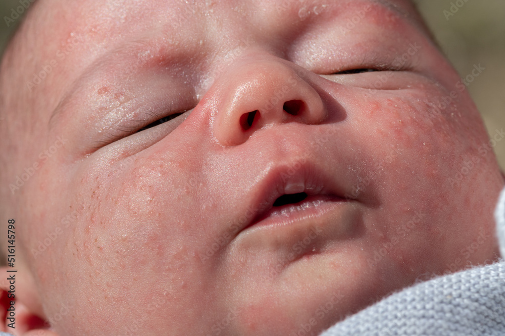 portrait of the face of a newborn baby with red cheeks with small