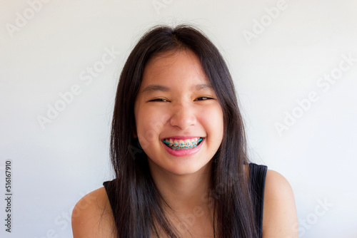 portrait of asian woman face with colorful braces and smile happily photo