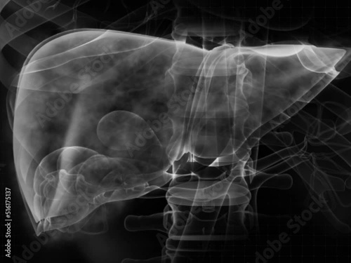 Abdomial X-ray diagnosis of liver scan and biliary tract diseases. footage vedio 4k. photo