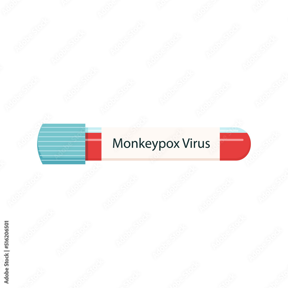 Monkeypox virus concept. Monkey pox MPXV virus sample blood in test tube. Color flat vector illustration isolated on white background Monkeypox virus concept. Monkey pox MPXV virus sample blood in test tube. Color flat vector illustration isolated on white background