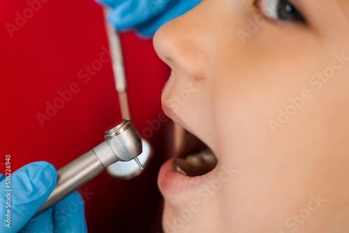 Dental drill close-up. Child dentist drilling teeth of kid girl in dentistry clinic. Teeth treatment. Dental filling for child patient.