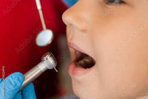 Dental drill close-up. Child dentist drilling teeth of kid girl in dentistry clinic. Teeth treatment. Dental filling for child patient.