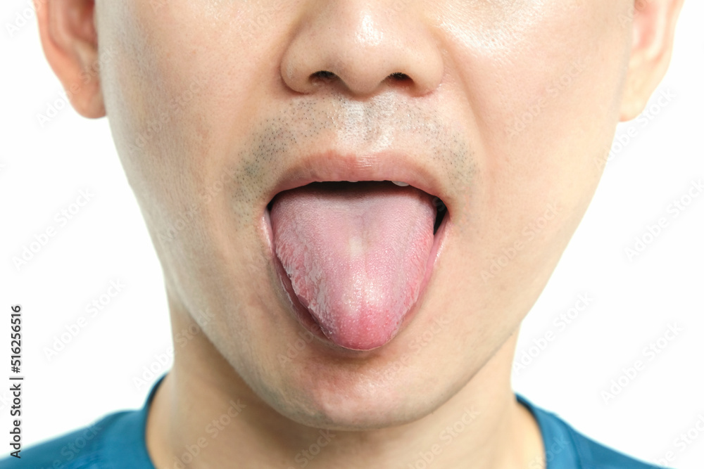 Close-up of a young man. He sticks his tongue out of his mouth to show his tongue. health and medical concepts Close-up of a young man. He sticks his tongue out of his mouth to show his tongue. health and medical concepts
