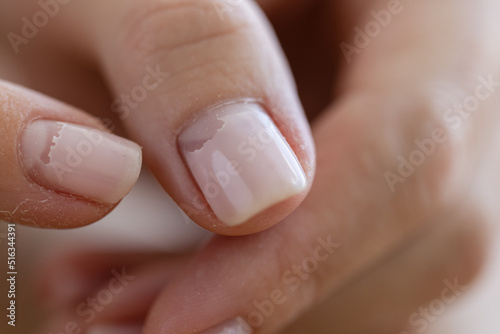 Cracked broken nail closeup. Nail weakness damage from gel polish coating. photo