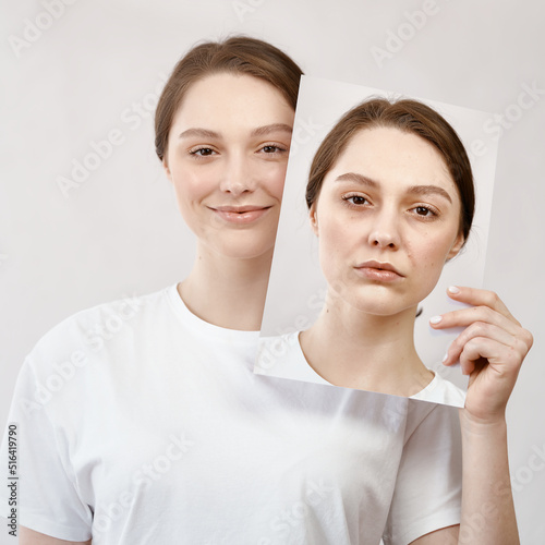  Young woman holds her photo before skin treatment.Before and after beauty procedure. Revitalisation spa procedure concept.  photo
