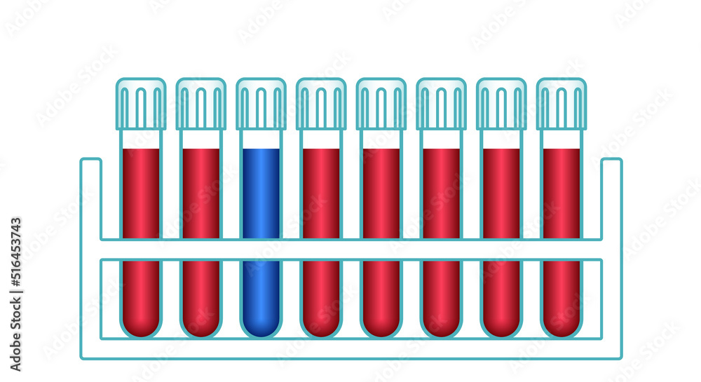 Laboratory test tubes