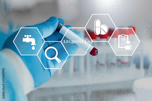 Legionella test medical concept. Bacteria in human lungs diagnosis causative agent of legionnaire's disease.