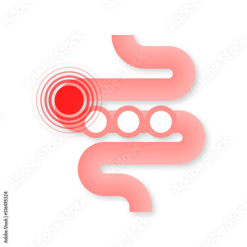 Colitis. Stomach. Abdominal, bloating. Health care. Vector illustration.