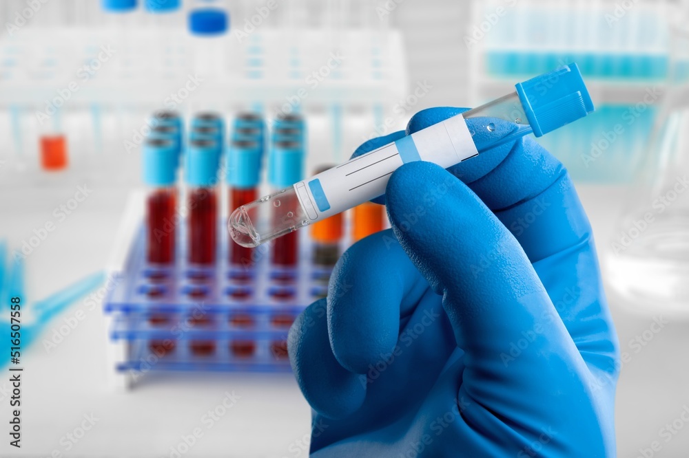 Blood sample of patient for test in laboratory. doctor with Blood tube