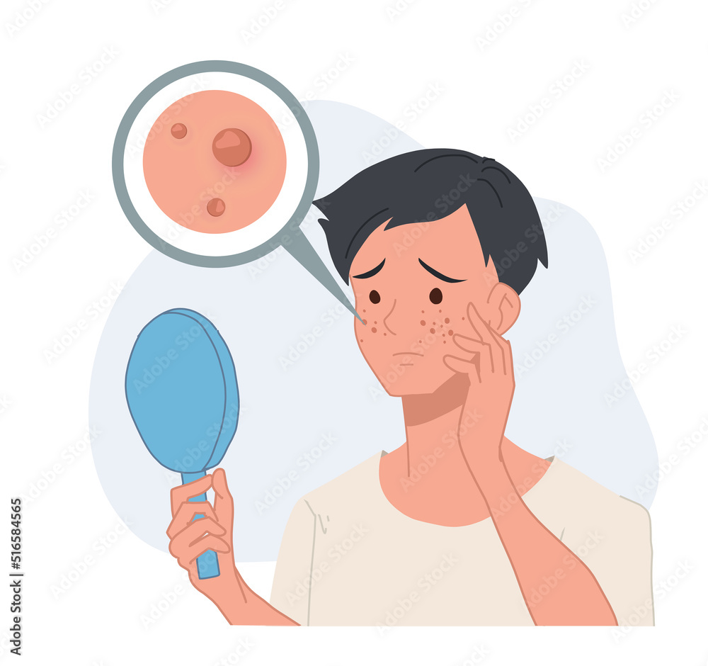 man looking into mirror,acne problem.skin problem. skin care concept. Flat vector cartoon character illustration. man looking into mirror,acne problem.skin problem. skin care concept. Flat vector cartoon character illustration.